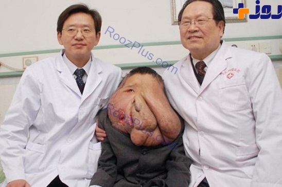 مرد فیل نما جراحی شد! +تصاویر
