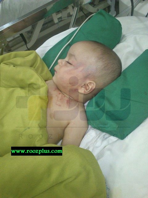 جزئیات شکنجه پسر 5 ماهه در رشت / حق دارم فرزندم را بزنم !! + تصاویر
