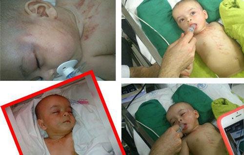 جزئیات شکنجه پسر 5 ماهه در رشت / حق دارم فرزندم را بزنم !! + تصاویر
