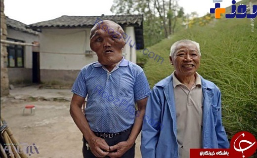 بیماری عجیب و غریب مرد چینی +عکس