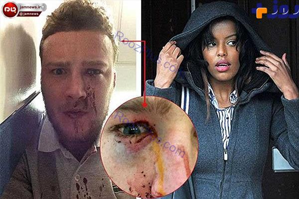 ماجرای چاقوکشی دختر دانشجو بخاطر توهین پسر جوان +عکس