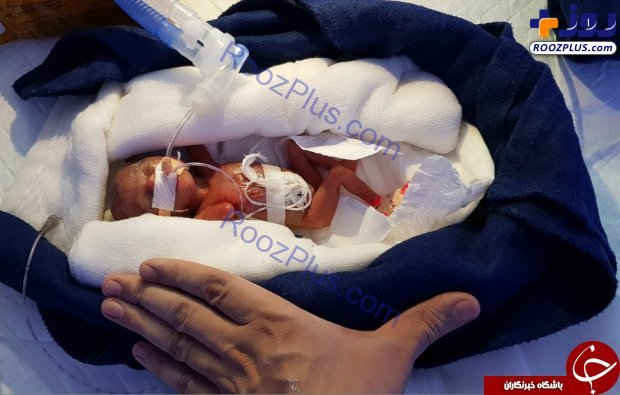 نجات معجزه آسای کم وزن ترین نوزاد جهان +تصاویر