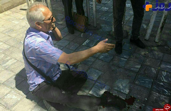 اولین مجروج تیراندازی در مجلس+ عکس