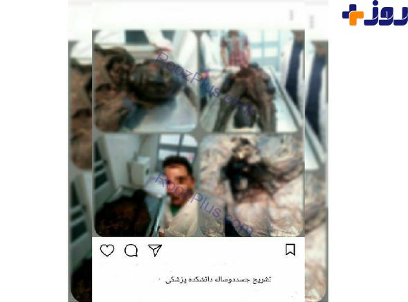 سلفی زننده دانشجوی پزشکی با یک جسد! /عکس 18+