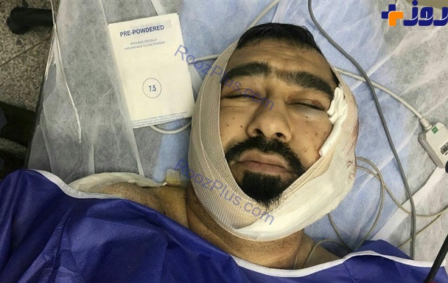 حمله وحشیانه جوان شیطان پرست به یک روحانی در شرق تهران + تصاویر
