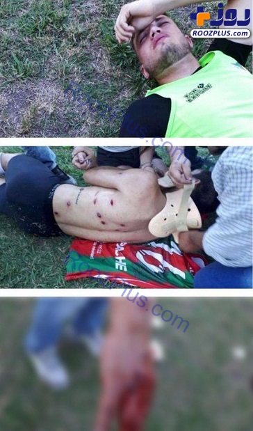 پلیس بازیکن معروف را به گلوله بست+عکس