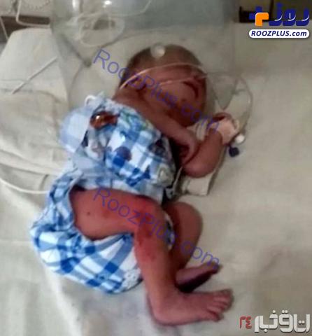 نوزادی که به خاطر دختر بودن در خیابان رها شد+عکس
