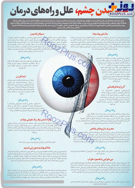 اینفوگرافیک/ ۸ علت قرمزی چشم و راهکارهای درمانی