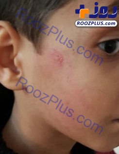 ماجرای تنبیه دانش‌آموز قزوینی چیست؟ +عکس