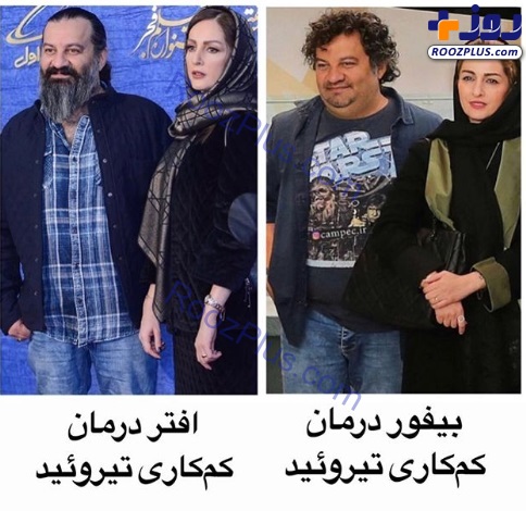 مهراب قاسم خانی قبل و بعد از کم کاری تیروئید +عکس