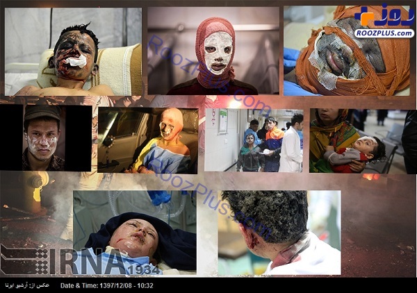 تصاویر آرشیوی از مصدومان حوادث چهارشنبه سوری +عکس