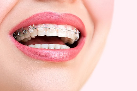 اهمیت تخصص دندانپزشک در سلامت دندان