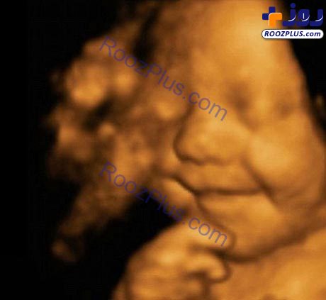 خوشحال ترین بچه جهان به دنیا آمد! +عکس