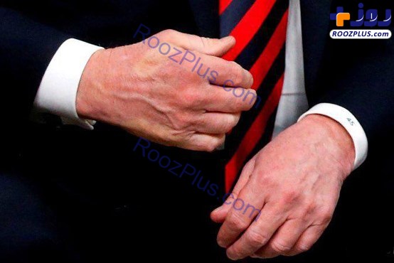 عکس/ وقتی دست‌های ترامپ کم می‌آورد