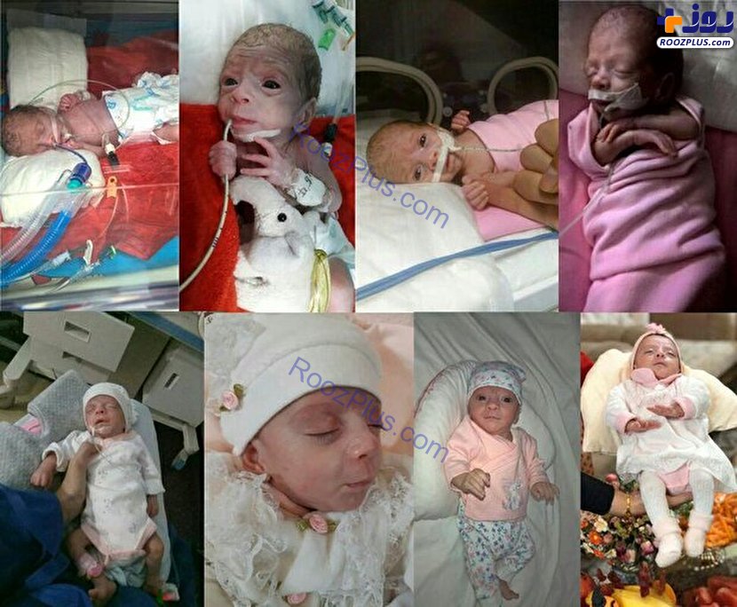 تولد نوزاد نیم کیلویی در قم +عکس