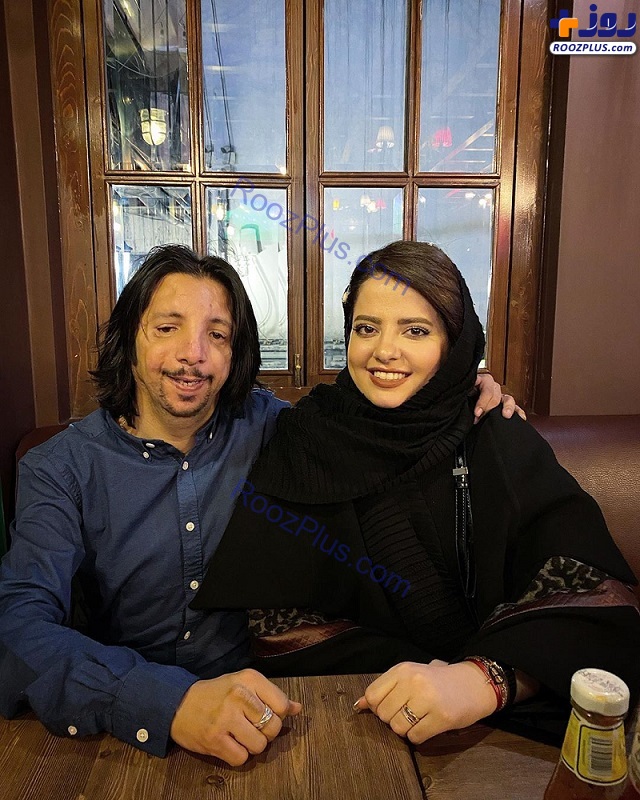 فرهاد ایرانی بعد از بهبود حالش در کنار همسرش +عکس