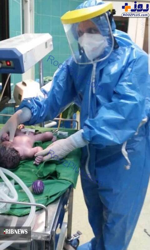 تولد نوزاد سالم از مادر مشکوک به کرونا در سمنان/عکس