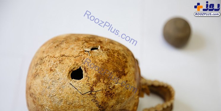 کشف جمجه‌های ۴۰۰۰ ساله با دوسوراخ!+ تصاویر