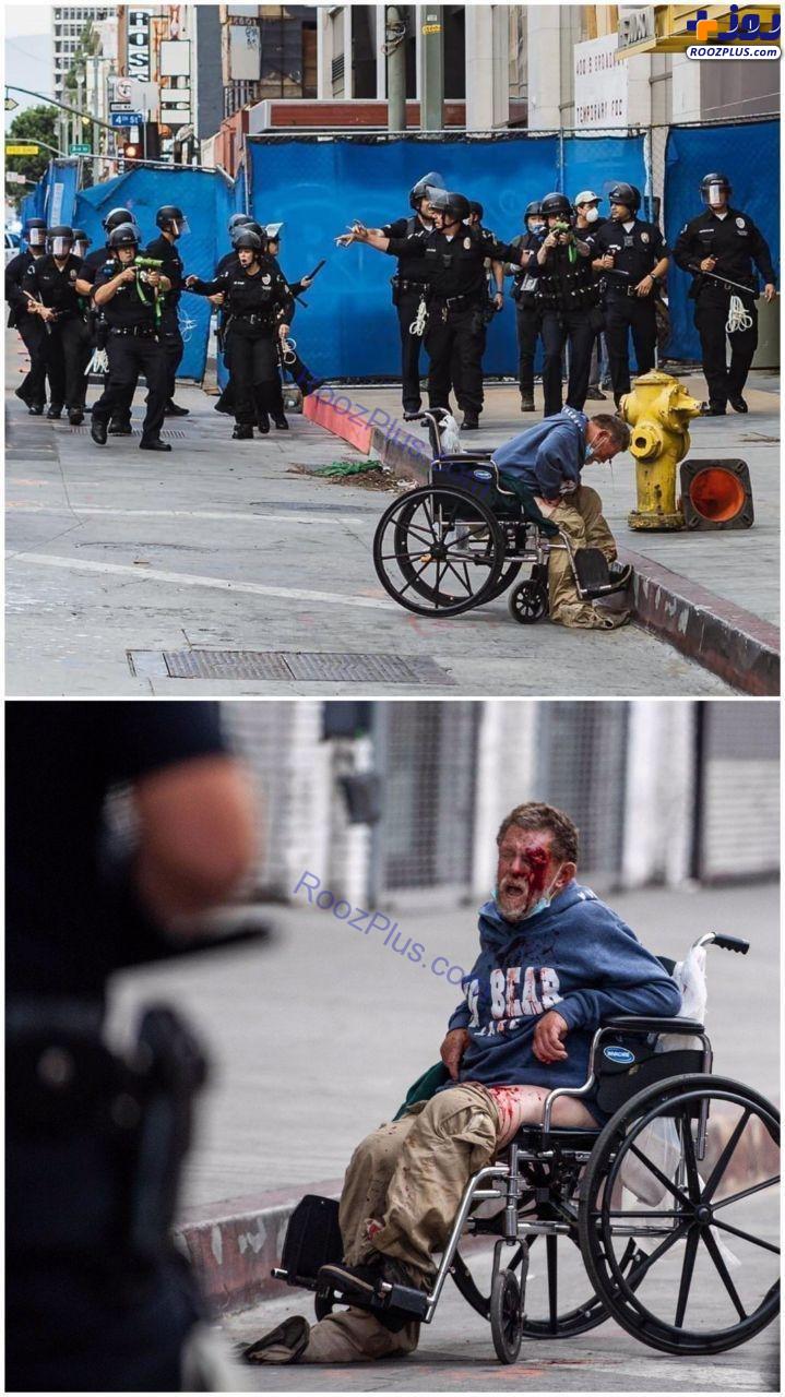 معلول بی‌خانمان هدف پلیس لس آنجلس! +عکس