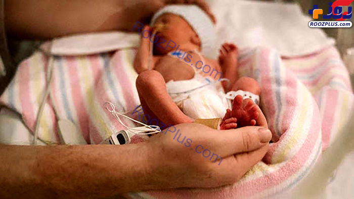 تولد نوزاد نیم کیلویی در ایران + عکس