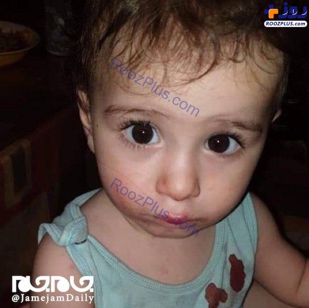 این کودک ۲۶ ساعت بعد از انفجار بیروت، از زیر آواز زنده پیدا شد +عکس