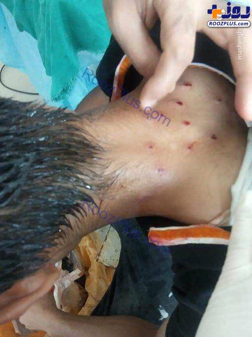 مجروح شدن دلخراش عزاداران حسینی /عکس