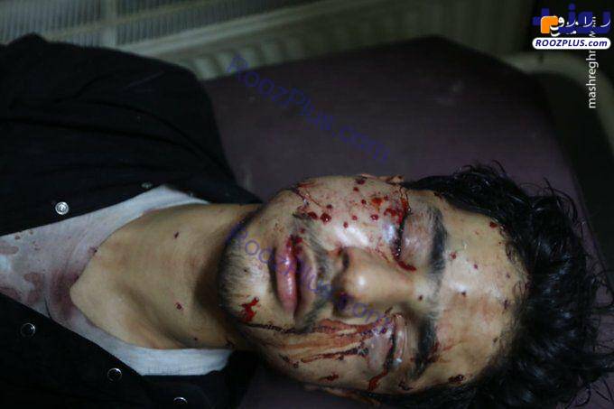 مجروح شدن دلخراش عزاداران حسینی /عکس