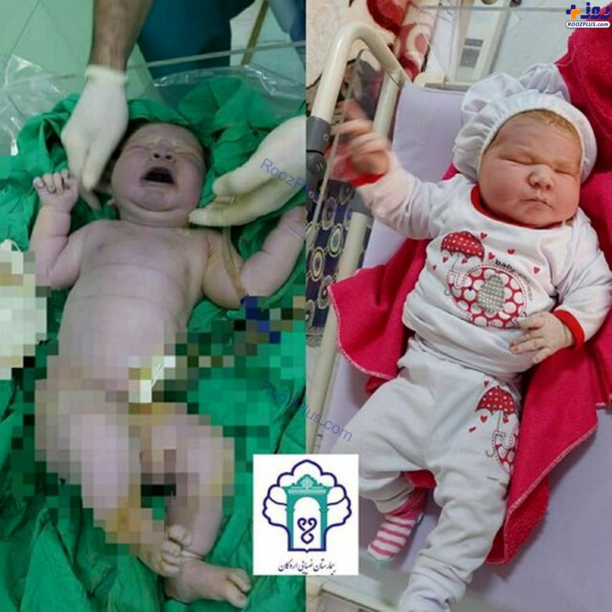 تولد نوزاد 9 کیلویی در یزد+عکس