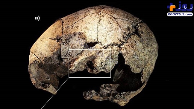 جمجمه‌ای که نشان از جراحی گوش در ۵۳۰۰ سال قبل دارد +تصاویر