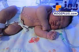 عکس/حیرت پرستاران از وزن سنگین یک نوزاد!