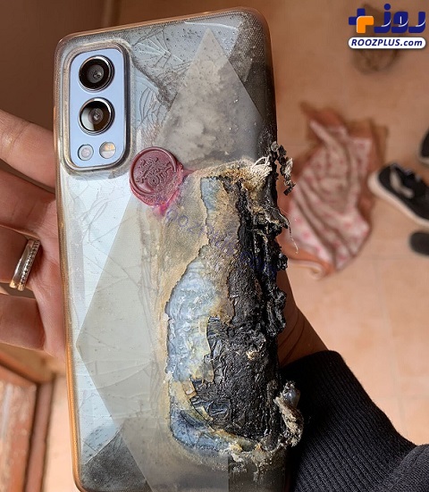 سوختگی شدید یک کاربر به دلیل انفجار گوشی OnePlus Nord ۲ +تصاویر
