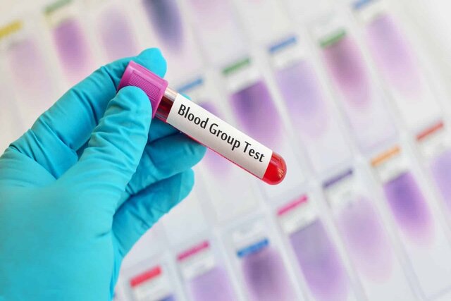 دانشمندان یک گروه خونی نادر جدید کشف کردند