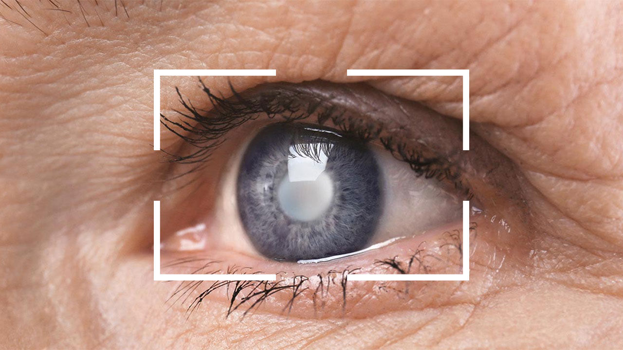 آسیب بینایی در دیابتی ها چه زمانی مشخص می شود؟
